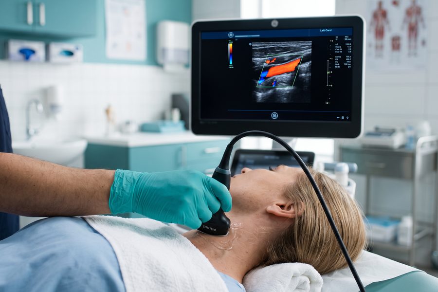 Ultrassom de Carótidas e Vertebrais